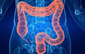 La AECC pide más concienciación a sociedad sobre cribado de cáncer de colon