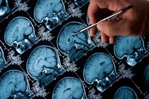 Caja Rural de Soria apoya la investigación de Alzheimer