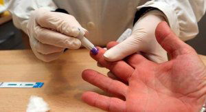 Las farmacias detectan un centenar de posibles positivos en Sida Las farmacias detectan un centenar de posibles positivos en Sida