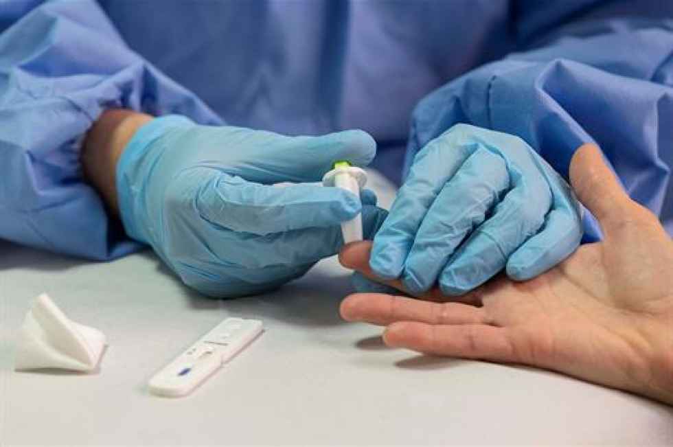 El CSIC logra un test de anticuerpos que detecta inmunidad