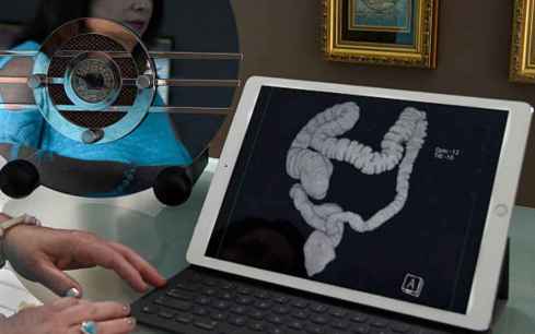 La AECC anima a población a “Jugar su papel en la detección precoz del cáncer de colon”. La AECC anima a población a “Jugar su papel en la detección precoz del cáncer de colon”.