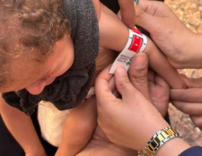 43 millones de niños menores de cinco años sufren desnutrición aguda en el mundo 